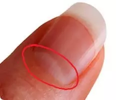 Лунула на нокътя на ръката