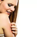 Екземата напада през лятото