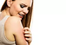 Екземата напада през лятото