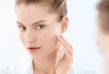 Петна по кожата