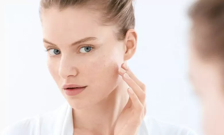 Петна по кожата