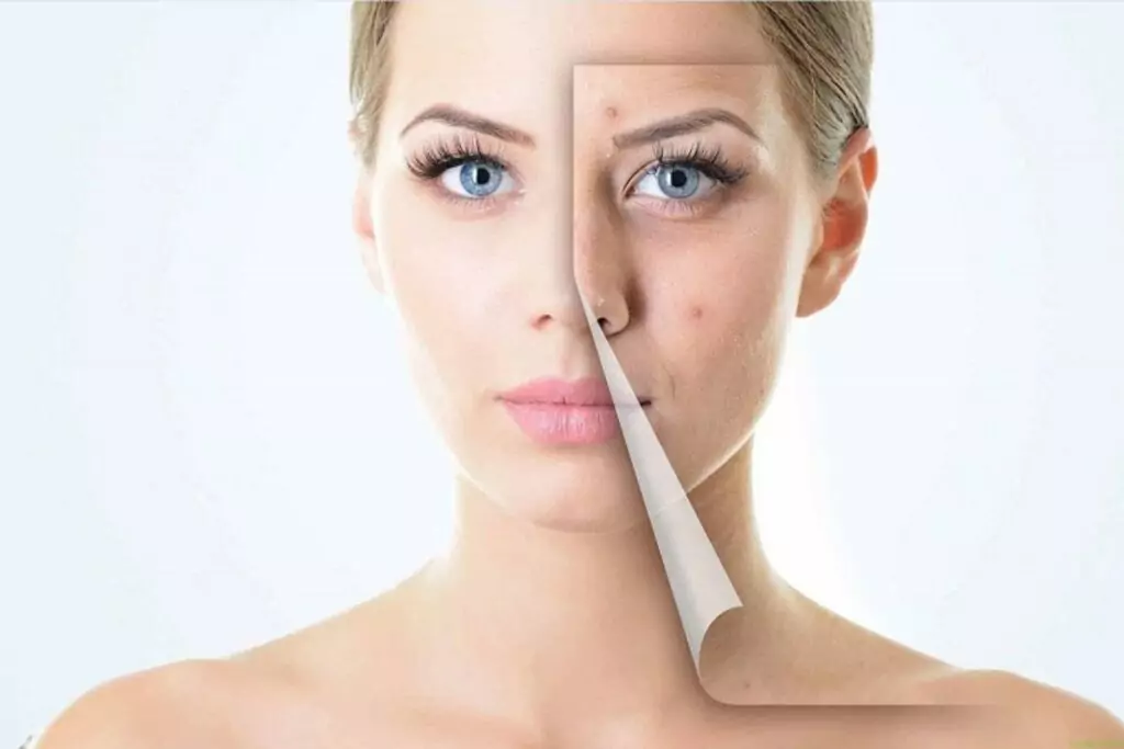 Пъпки Пъпки