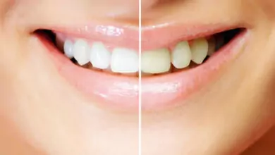 зъбната плака