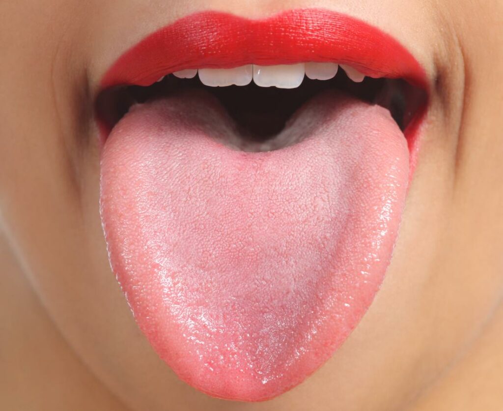 Цветът на езика сигнализира за куп болести