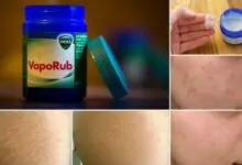 11 неизвестни приложения за евтин мехлем от аптеката