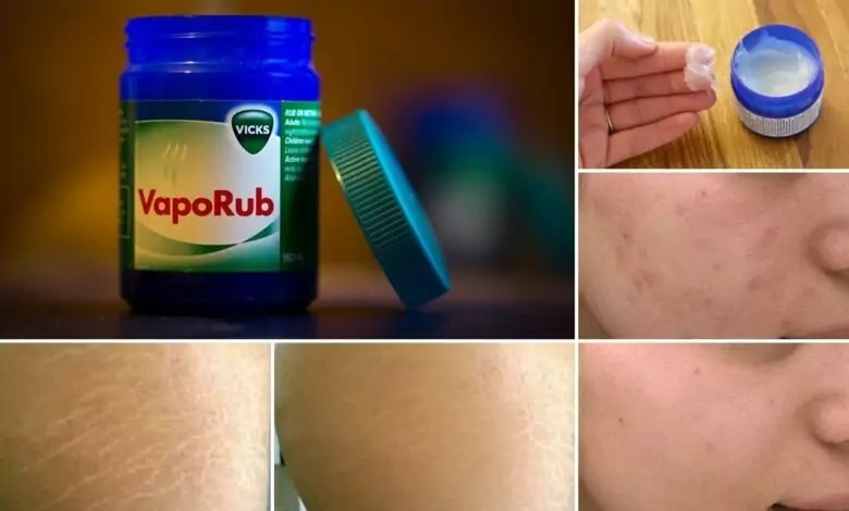 11 неизвестни приложения за евтин мехлем от аптеката