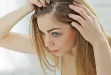 Защо някои хора си скубят косите?